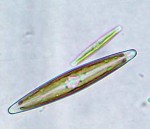 Microorganismos en los reinos Protistas y Fungi (Hongos)