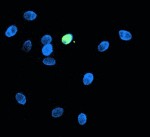 Gametogénesis: la formación de los espermatozoides