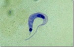 El protista detrás del Chagas