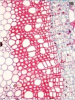 Xilema, haces vasculares de plantas