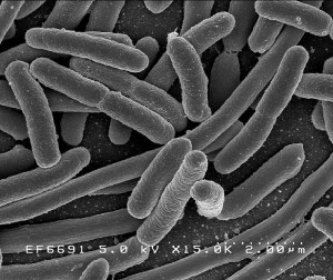 Colonias de Escherichia coli al microscopio electrónico de barrido