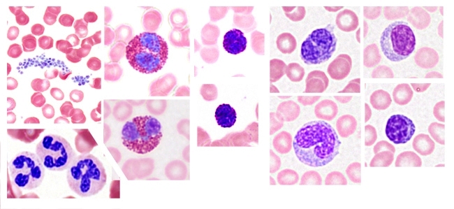 Microfotografía de algunas de las células sanguíneas