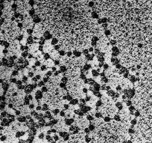 Vista al microcopio electrónico de la fibra de cromatina de 10 nm