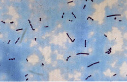 Un cultivo mixto de Lactobacillus (en la foto los bacilos) y de Streptococcus (los cocos) es el iniciador del yogur.