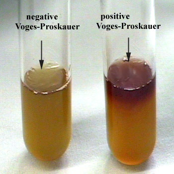 Las bacterias del género Klebsiella dan positivo para la prueba de Voges-Proskauer