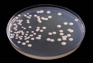 Levaduras crecidas en placa Petri