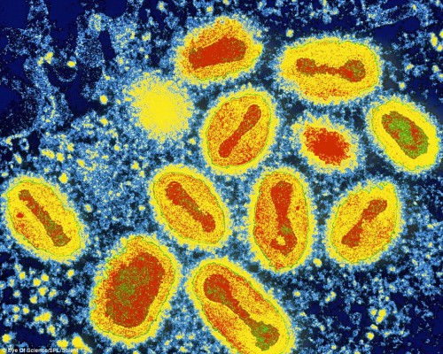 Una imagen coloreada del virus de la viruela