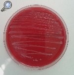 Listeria crecida en agar sangre 24 horas.