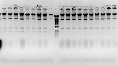 En medio el marcador lambda Eco471 y a los lados digestiones enzimáticas con HindIII para comprobar que un mutante ha perdido un fragmento de ADN.