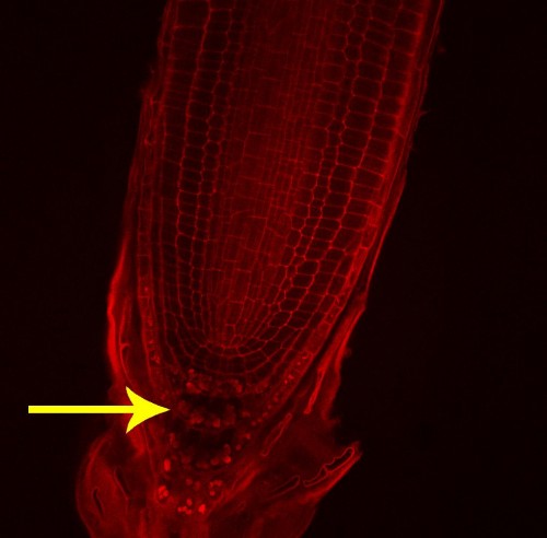 En la imagen se ven los amiloplastos de la raiz amontonados "abajo".