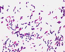 Típicos Bacillus teñidos y vistos al microscopio óptico