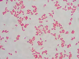 Tinción gram de E. coli