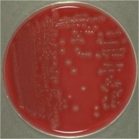 Cultivo en medio agar-sangre, © Institut for Veterinær Mikrobiologi