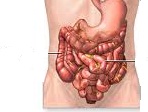 El cólera afecta a los intestinos, donde su toxina destruye la mucosa