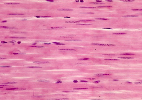 Tinción hematoxilina-eosina de los núcleos y las células del musculo liso.