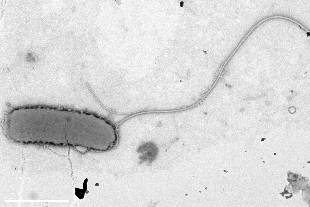 Imagen al microscopio de campo claro de una bacteria de V. cholerae, con su flagelo.