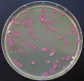 Bacterias púrpuras crecidas en placa