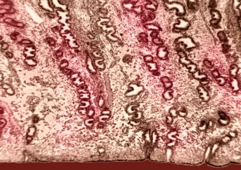 vista al microscopio de las glándulas esperiales durante la menstruación.
