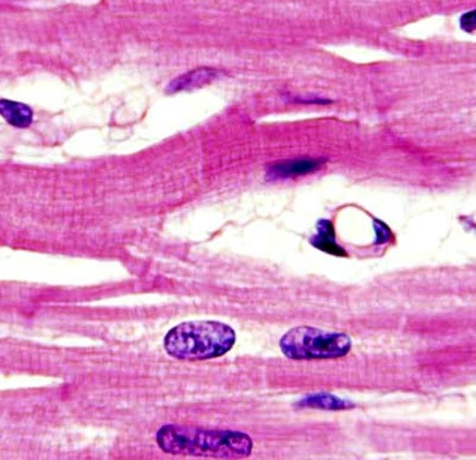 Corte histológico de tejido cardiaco, con los núcleos en azul. las bandas de actina y miosina son visibles en la tinción.