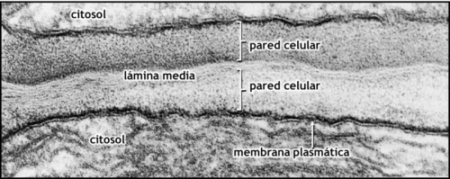 Vista al microscopio electrónico de la pared celular vegetal.