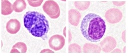 Los diferentes tipos celulares de la sangre pueden diferenciarse por citometría de flujo.