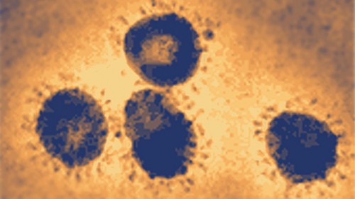 El SARS tiene la forma típica de los coronavirus al microscopio.