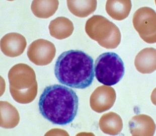 Los leucocitos se tiñen diferencialmente de los glóbulos rojos con la tinción de Wright