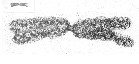 El scaffold de proteínas de un cromosoma de ajo.