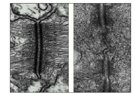 Imagen de microscopía electrónica de la unión entre dos células por un desmosoma.