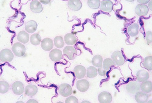 Con la tinción Giemsa se pueden observar parásitos en la sangre, como por ejemplo Trypanosoma evansi, en la foto. 