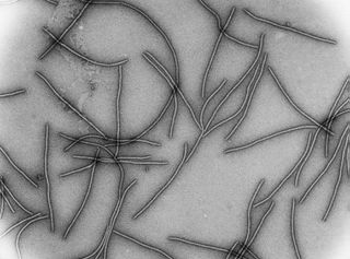 Los potyvirus tienen una apariencia filamentosa al microscopio.