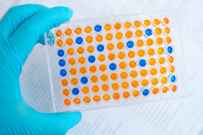 Cómo Funciona La Técnica De Inmunología Elisa La Guía De Biología 6715